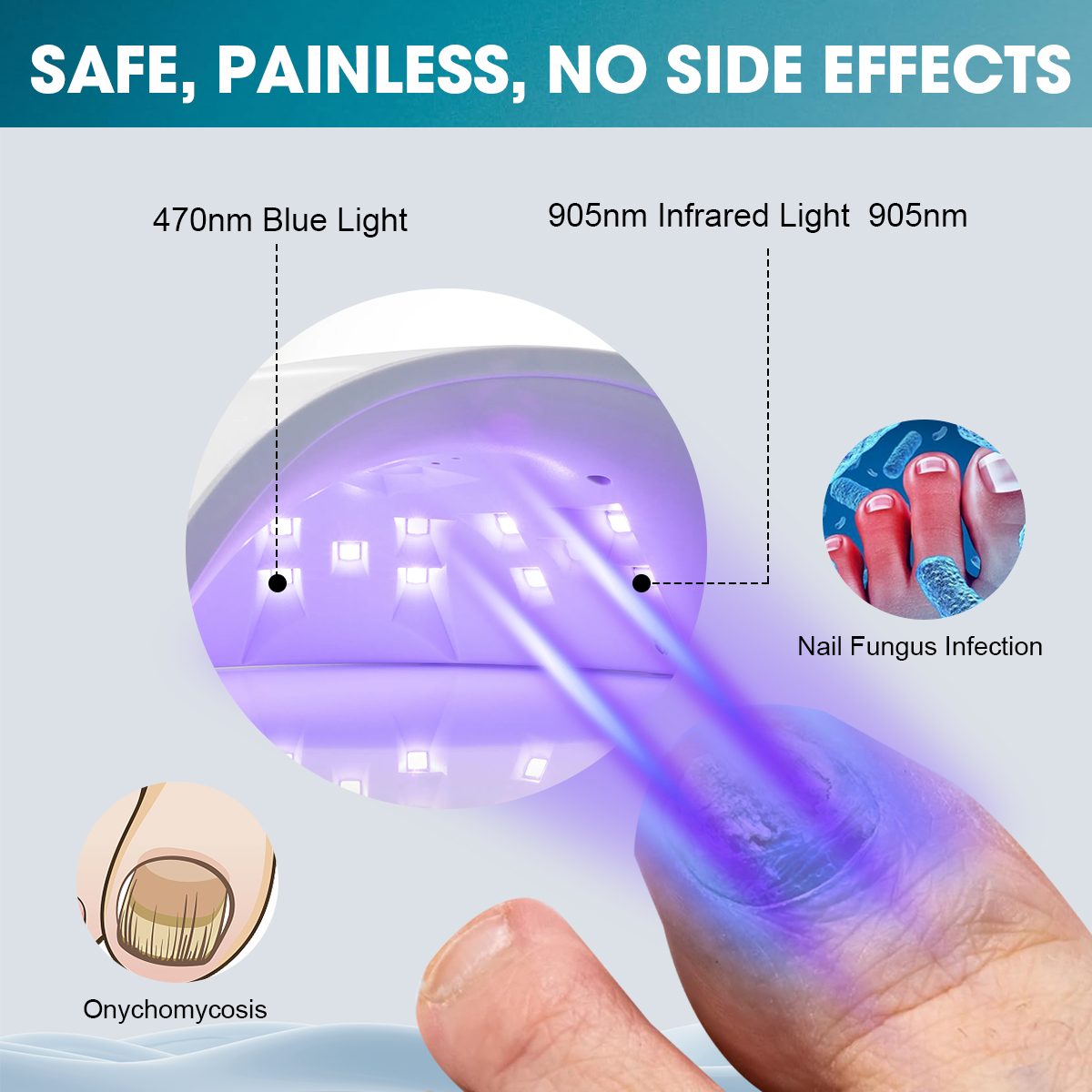Vathery Fungal Nail Light Device for Toenails and Fingernails - Image 4